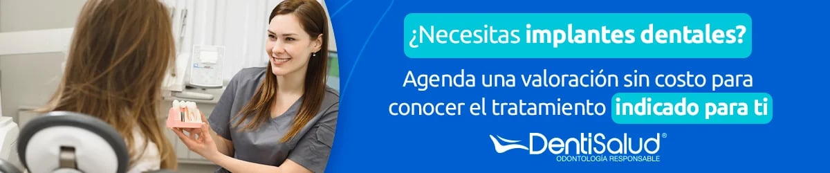 agenda una cita Consejos a tener en cuenta después de un implante dental