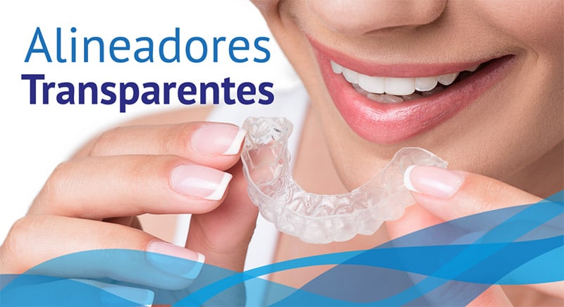Diseño de sonrisa con Alineadores Transparentes - DentiSalud