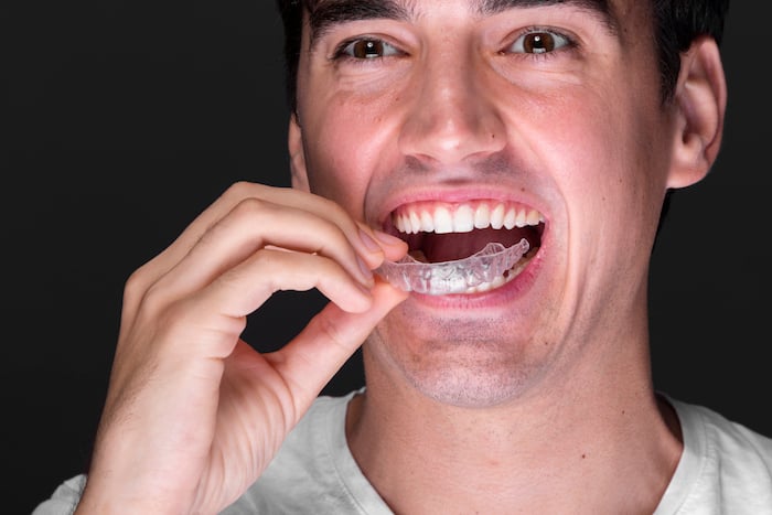 Diseño de sonrisa y alineadores