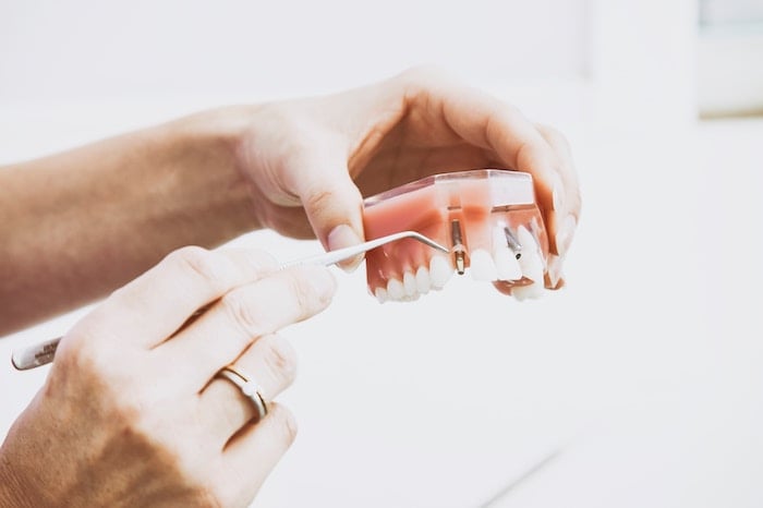 Soluciones a dientes fracturados