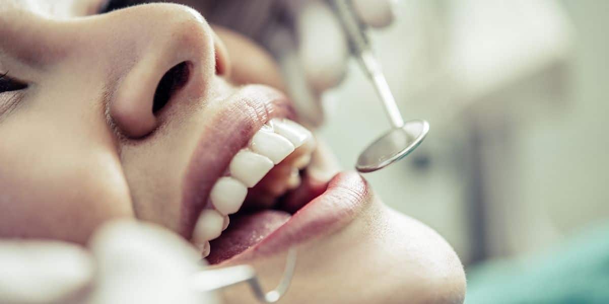 Limpieza dental un cuidado dental durante el embarazo