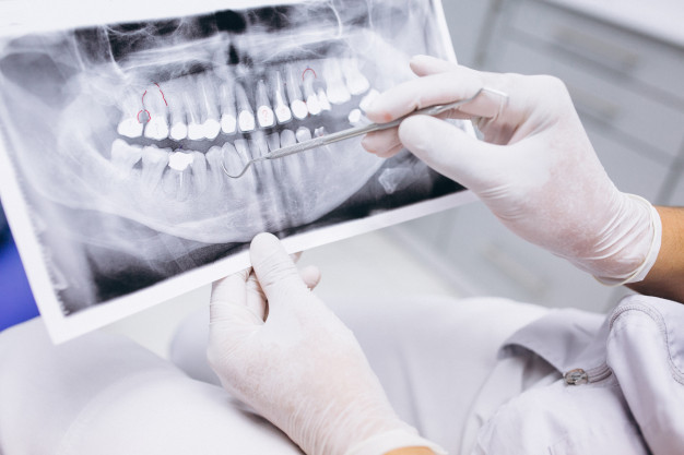 Si tienes un absceso acude al dentista
