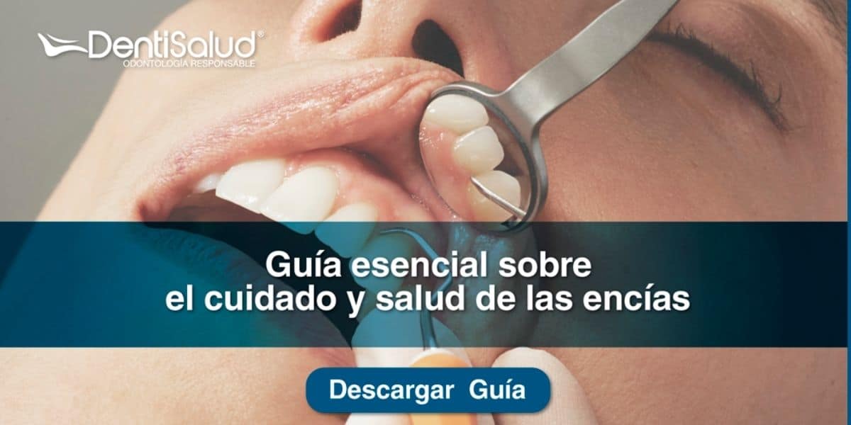 Ebook cuidado de las encías