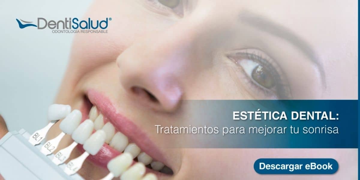 Ebook Estética Dental