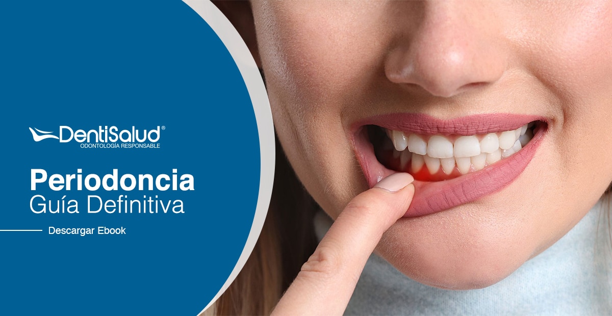 Ebook periodoncia Colombia