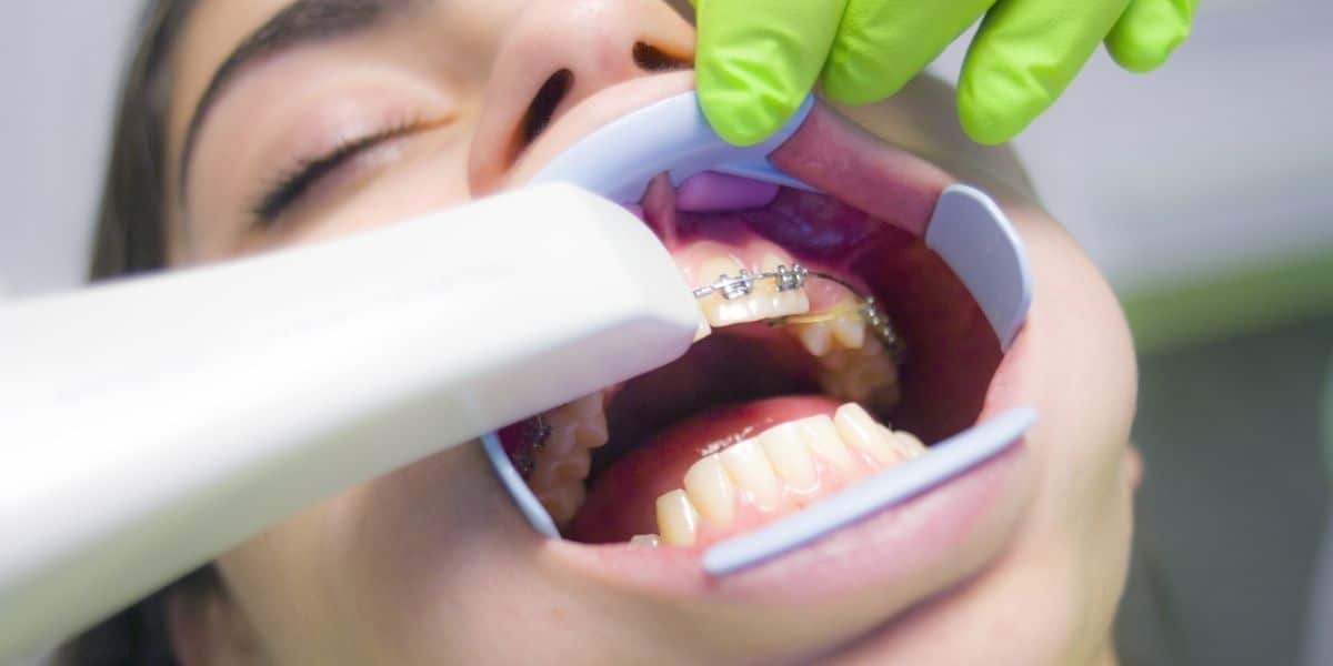 Estética dental ortodoncia
