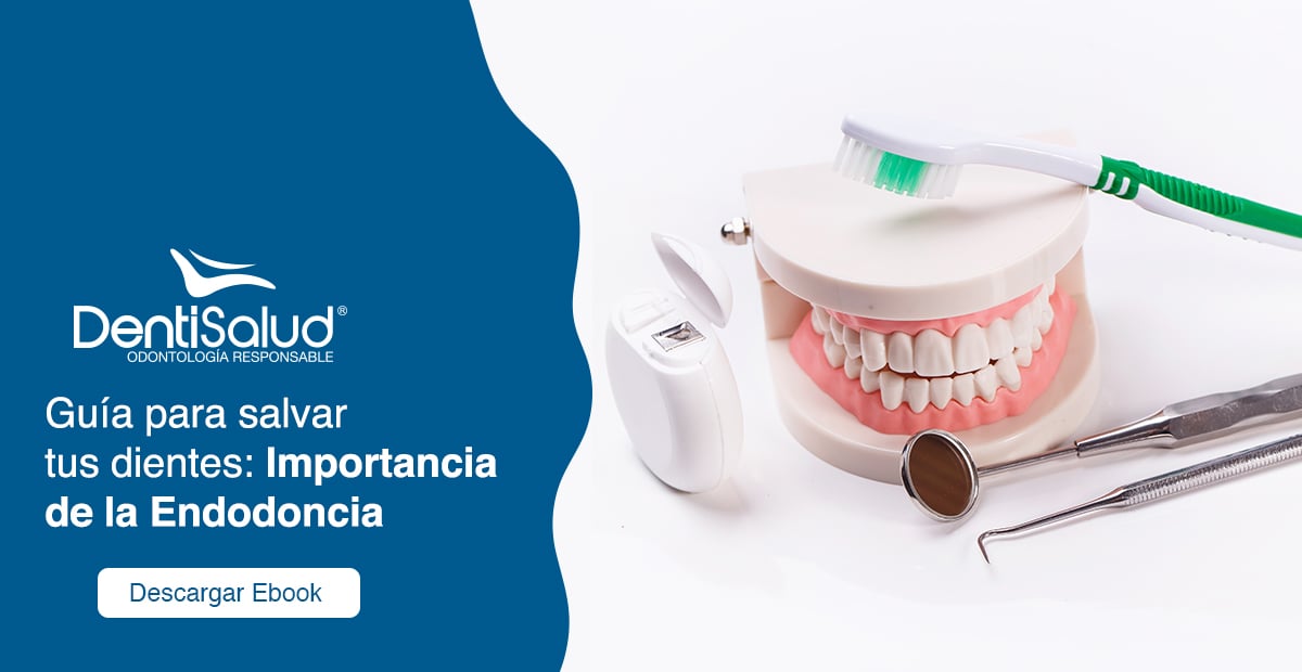 Guía para salvar tus dientes endodoncia