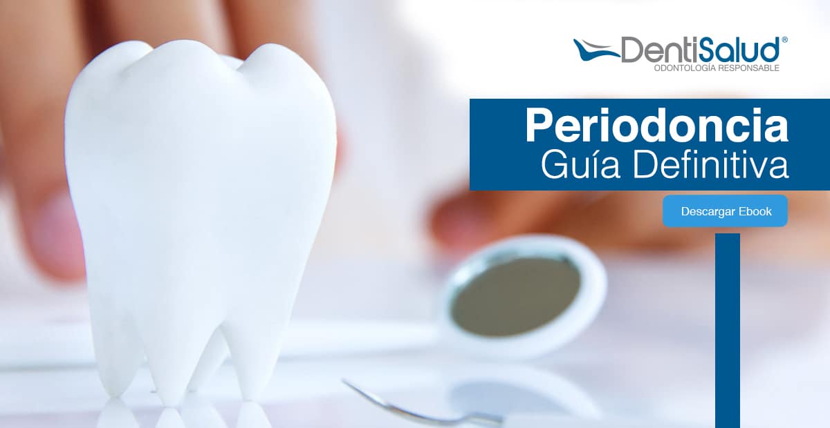 Guía sobre las periodoncias