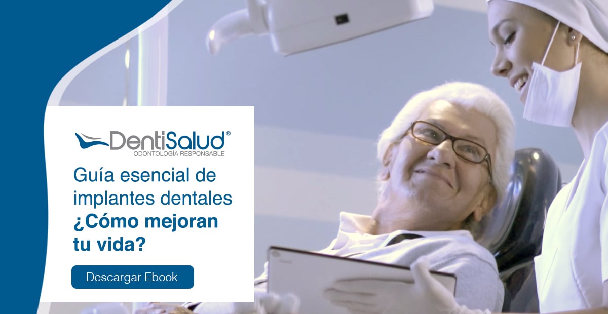 Por qué ponerse implantes dentales