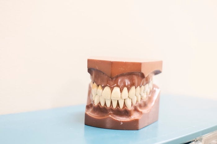 Dientes mal alineados