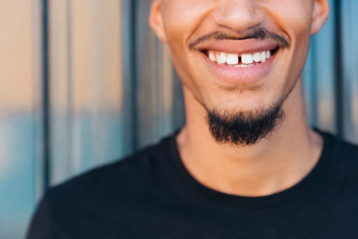 Movilidad dental sin uso de prótesis dental