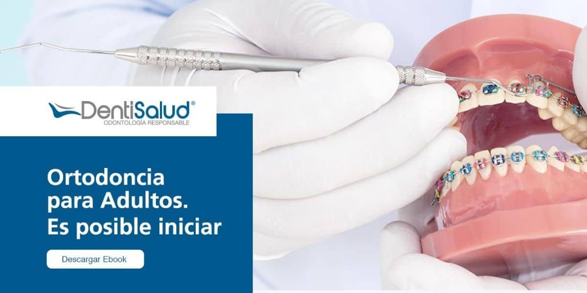 Ortodoncia para adultos