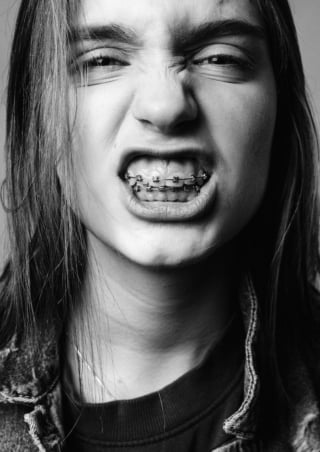 Ortodoncia invisible o brackets