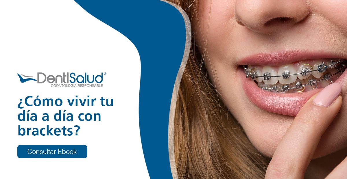 ¿Cómo vivir con ortodoncia?