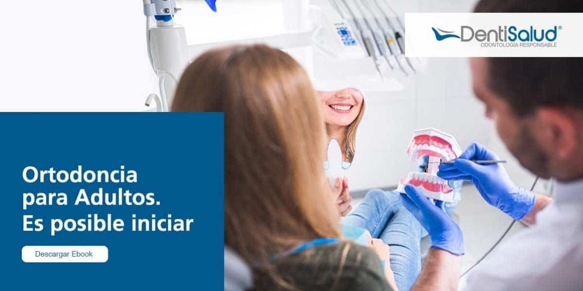 Brackets para adultos