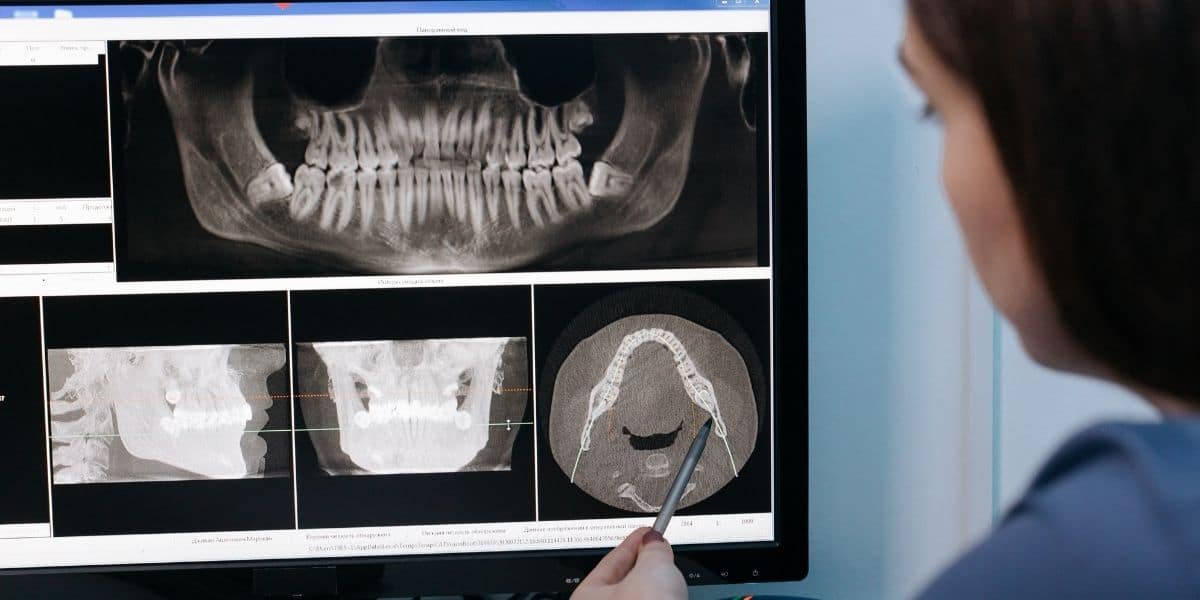 problemas dentales se corrigen con diseño de sonrisa