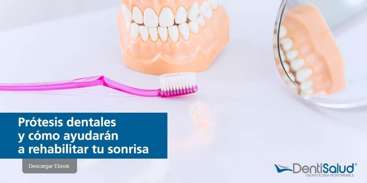 Prótesis dentales