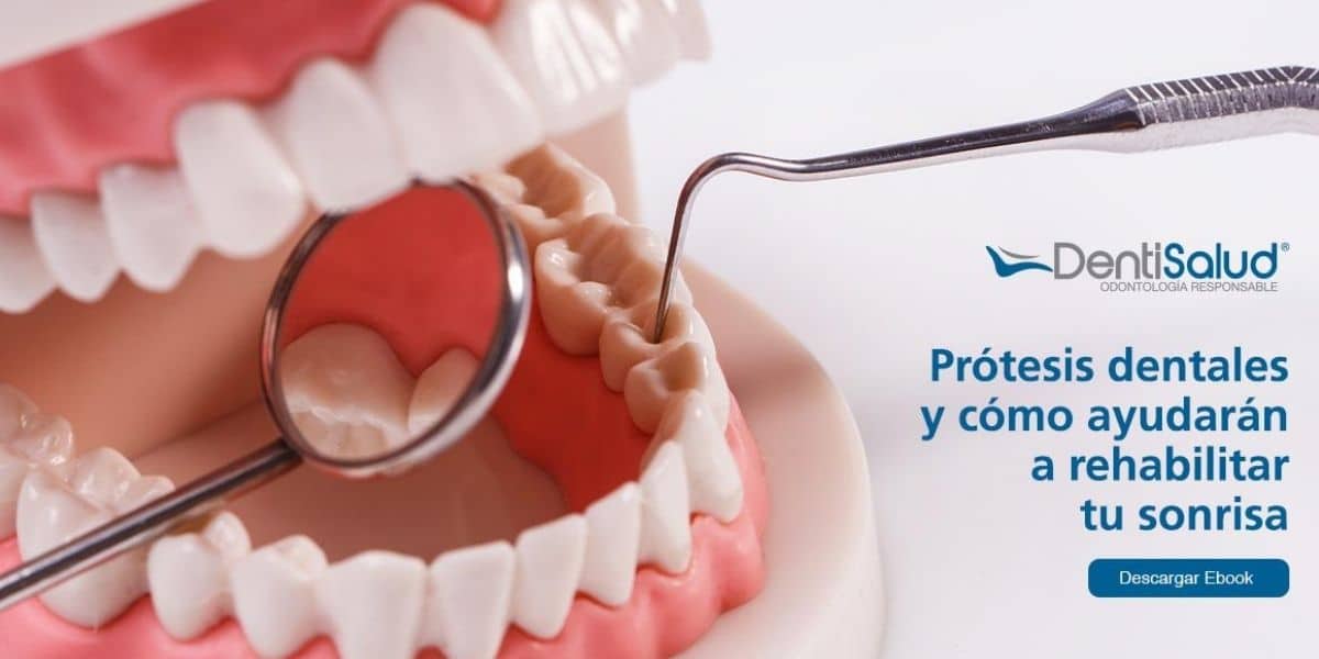 Prótesis dentales ebook
