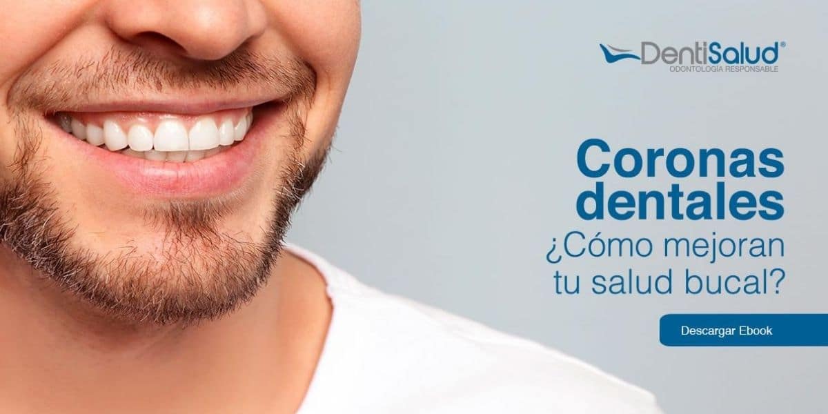 Ebook Coronas Dentales