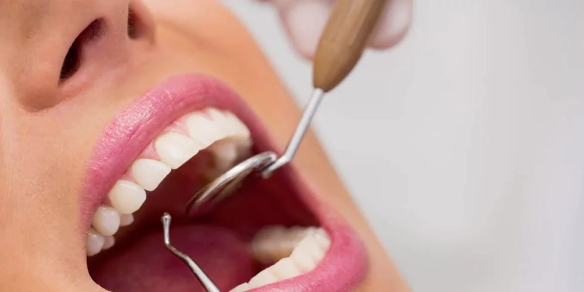 Odontología-Diagnostica-Problemas-Dentales-1