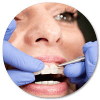 Ortodoncia Cerámica DentiSalud