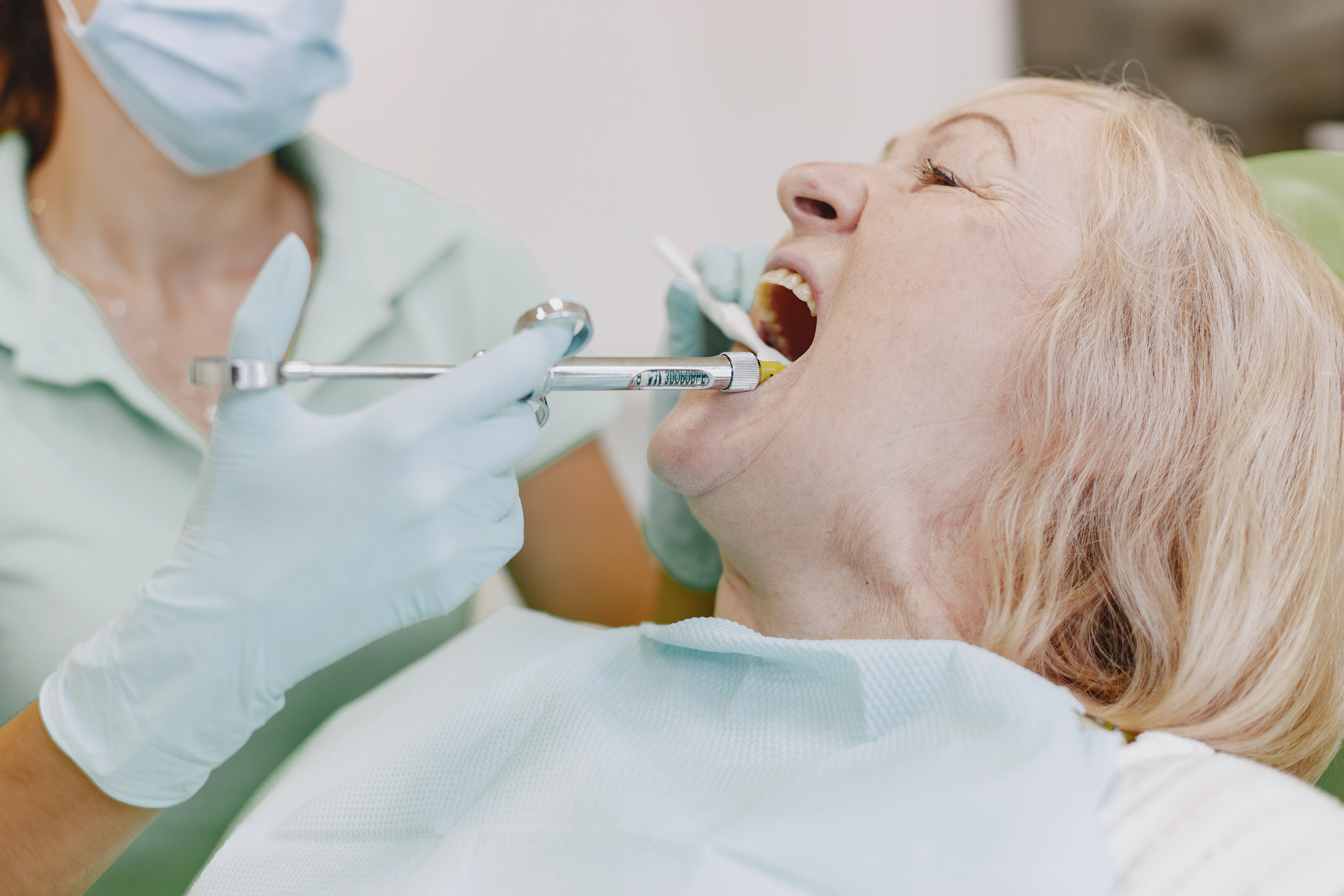 Se utiliza anestesia para realizar la endodoncia
