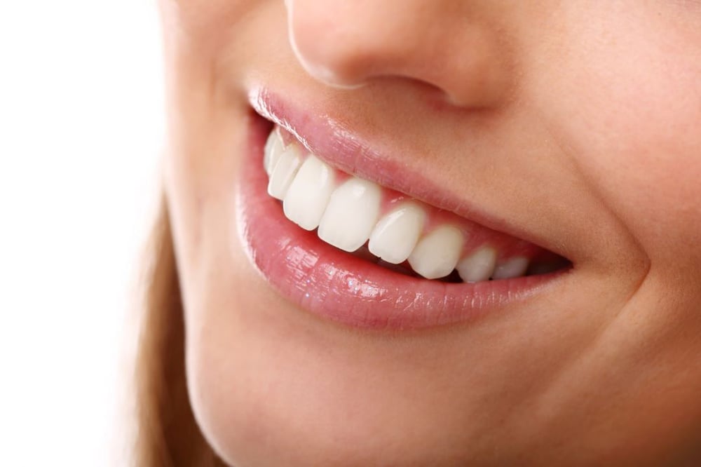 beneficios-ortodoncia-invisible-invisalign