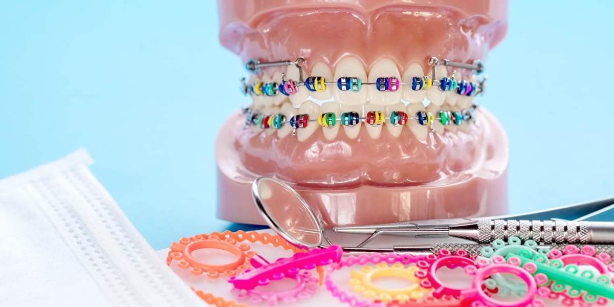 Colores de brackets para sonreír con confianza