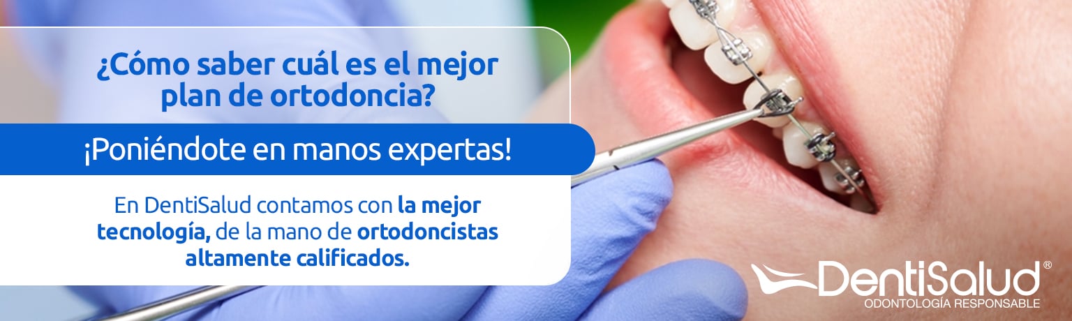 dentisalud-cual-es-el-mejor-plan