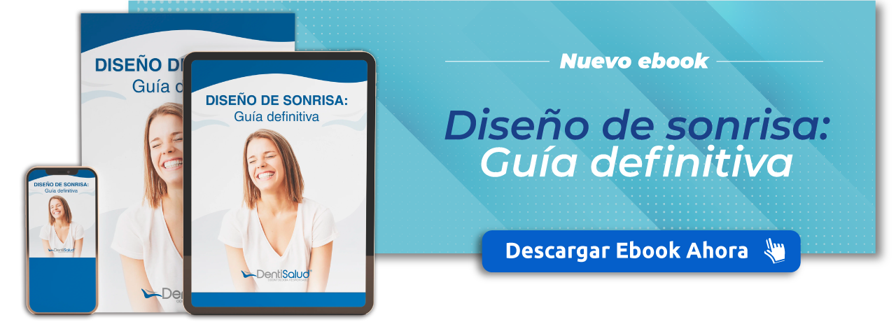 Nuevo Ebook: Diseño de sonrisa: Guía definitiva