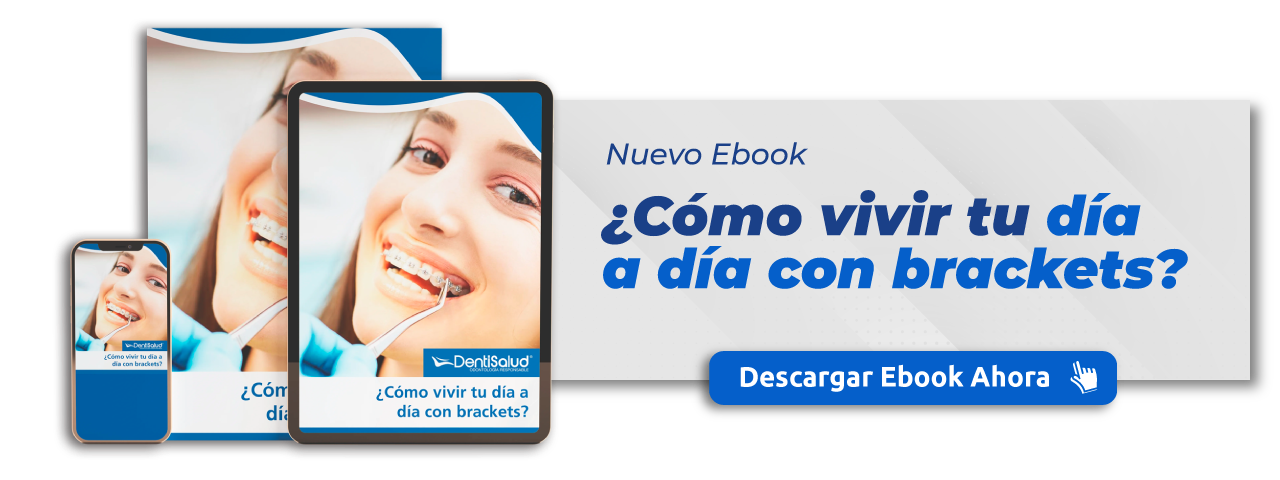 Descarga Gratis el Ebook: ¿Cómo vivir tu día a día con brackets?
