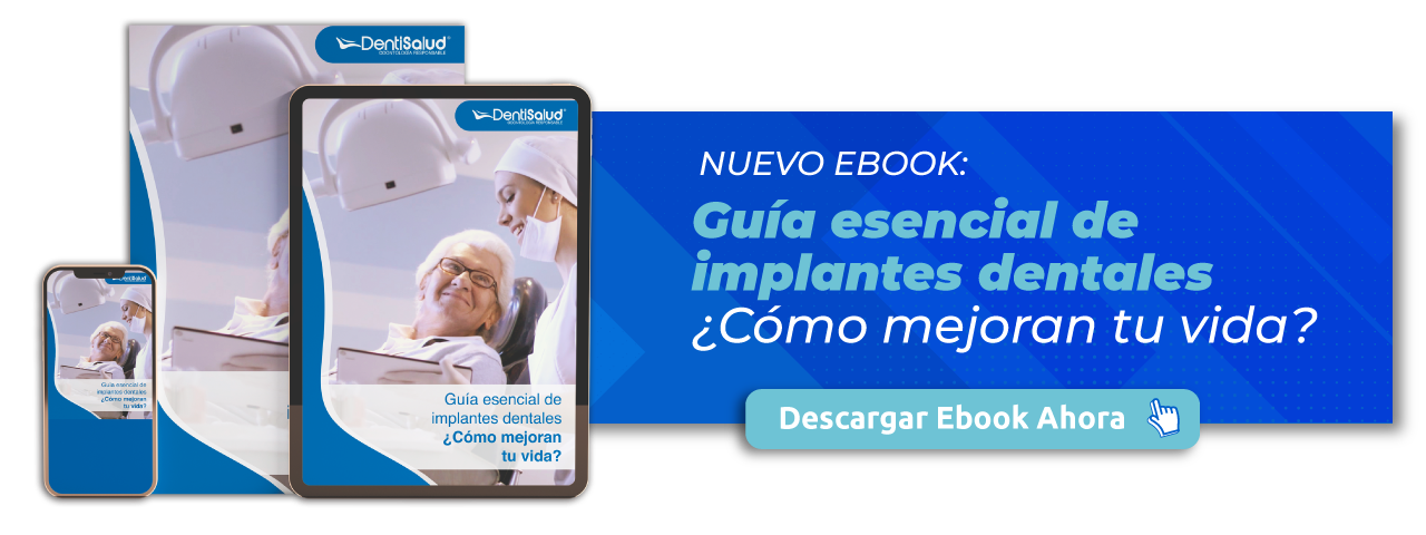 Nuevo Ebook: GUÍA ESENCIAL DE IMPLANTES DENTALES:¿CÓMO MEJORAN TU VIDA?