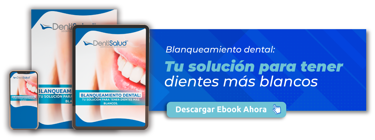 Nueva llamada a la acción