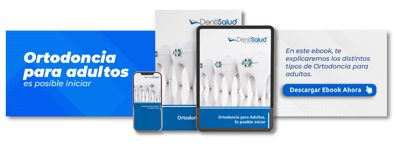 Descarga gratis el ebook: Ortodoncia para adultos es posible
