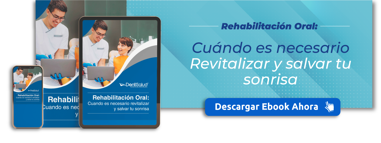 Descarga el ebook Gratis de Rehabilitación Oral: Cuándo es necesario revitalizar y salvar tu sonrisa - DentiSalud