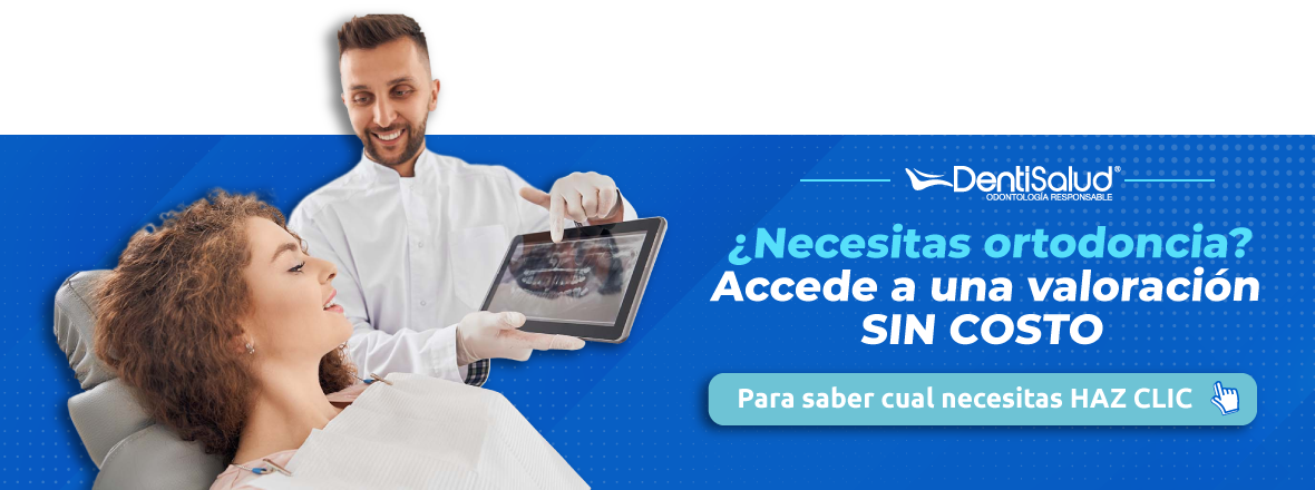 Si necesitas Ortodoncia, accede a la valoración sin costo e inicia tu tratamiento con DentiSalud