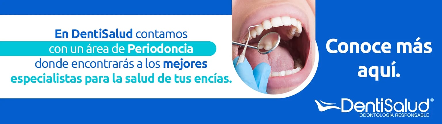 periodoncista-conoce-mas