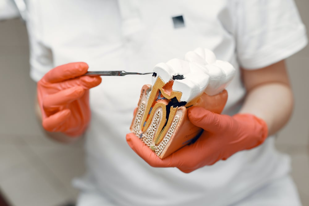 por-qué-necesito-tratamiento-del-nervio-dental