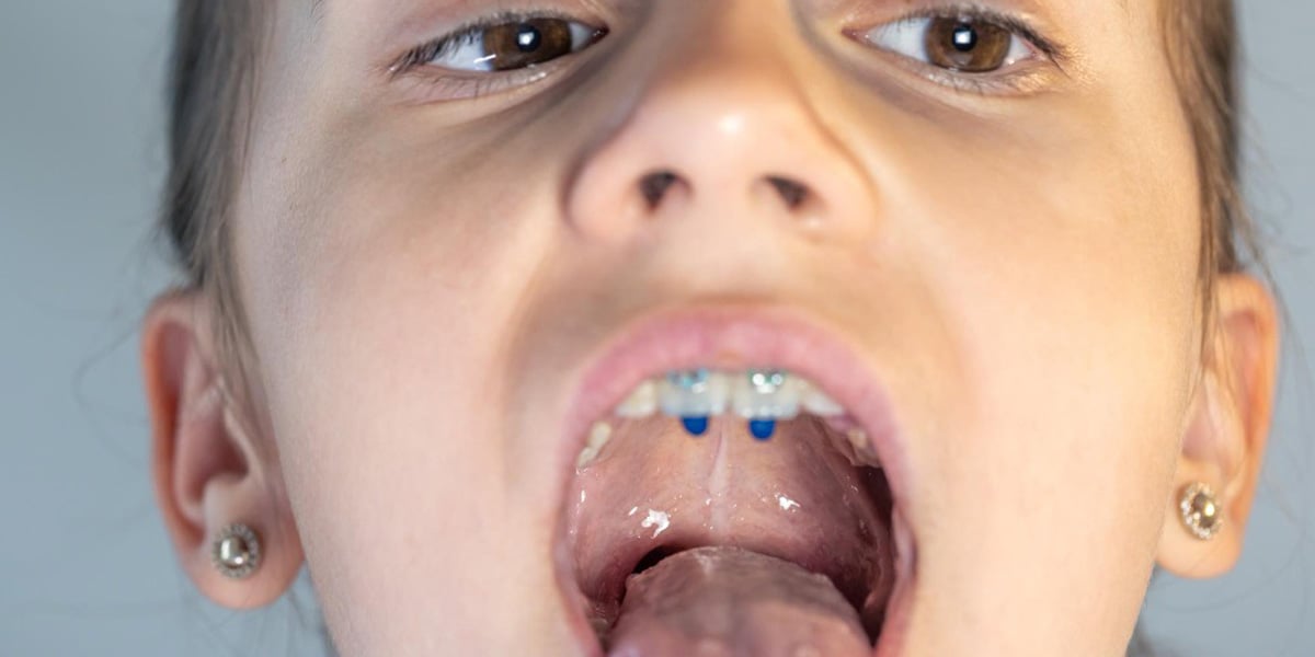 El propósito de la ortodoncia interceptiva