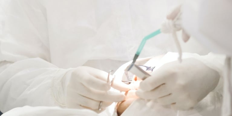 Razones para ponerte un puente dental