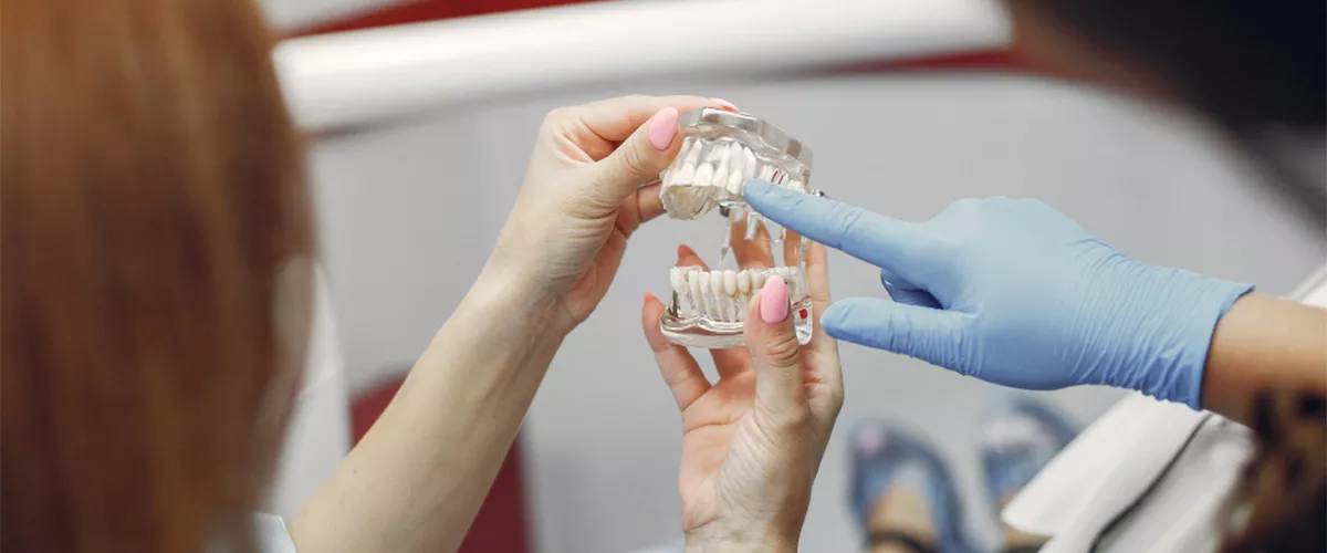 El implante dental mejora la estética de la sonrisa. 