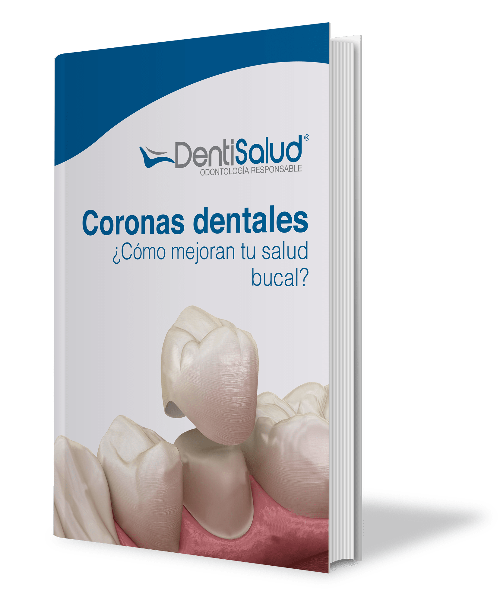 Coronas dentales: ¿Cómo mejoran tu salud bucal?