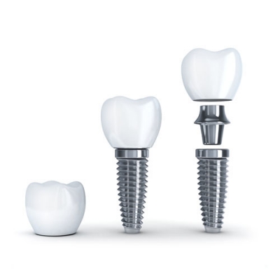 Implantes