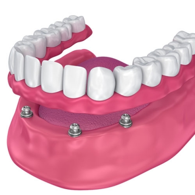 Rehabilitacion Oral