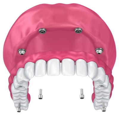 Rehabilitacion Oral