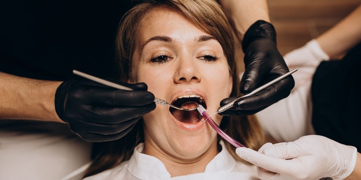 ¿Tienes un Diente Negro? Conoce las Consecuencias de las Caries