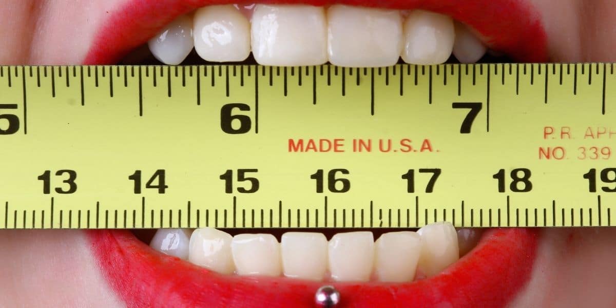 Cuando los dientes son de tamaños diferentes: Microdoncia y Macrodoncia