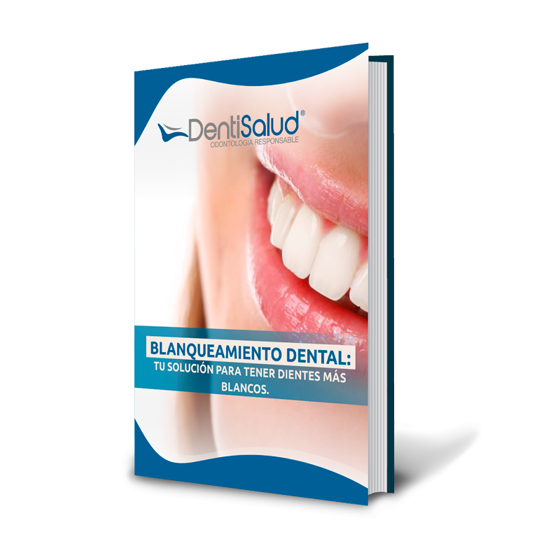 Descarga gratis el ebook Blanqueamiento Dental: Tu solución para tener dientes más blancos - DentiSalud
