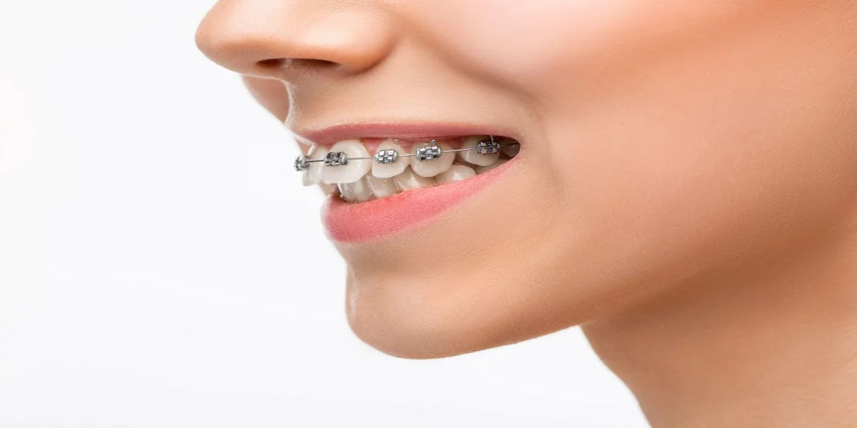 Odontología especializada 