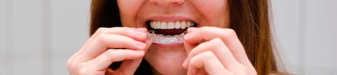 ortodoncia-cali-alineadores-transparentes-invisalign